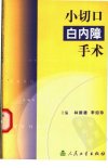 小切口白内障手术_11260956