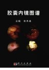 胶囊内镜图谱_12650287_张厚德编_2010.08