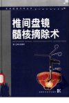 椎间盘镜髓核摘除术_11167501
